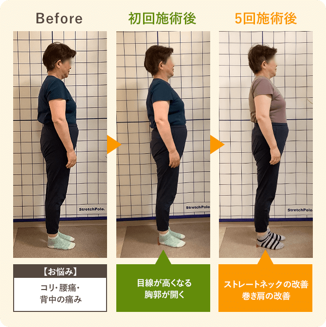 50代女性姿勢改善ビフォーアフター